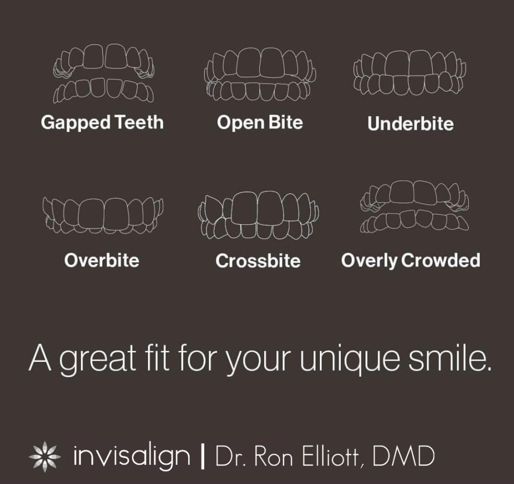 Invisalign by Dr. Ron Elliott Dentist Florence KY Cosmetic Dentist in